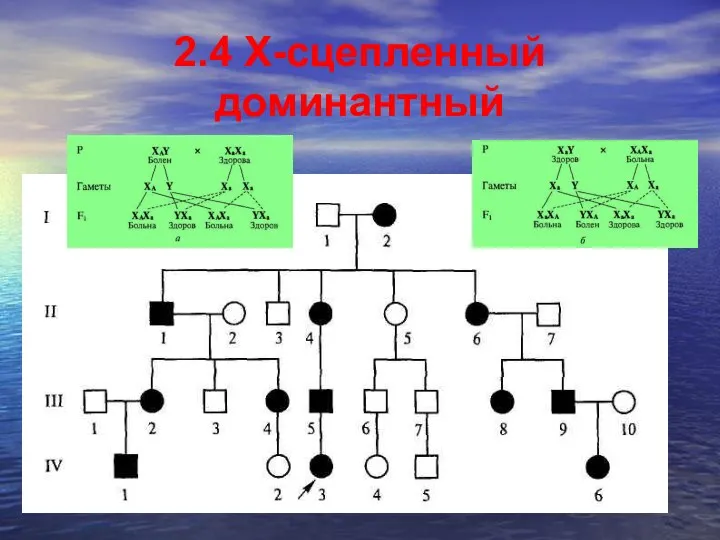 2.4 X-сцепленный доминантный