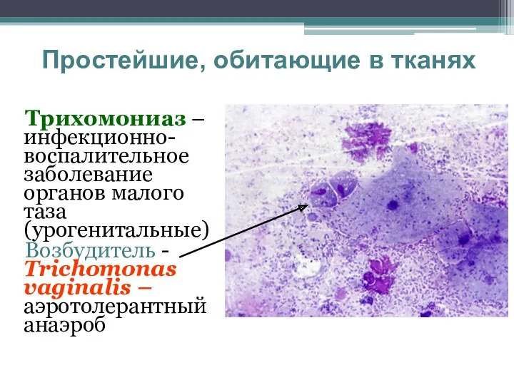 Простейшие, обитающие в тканях Трихомониаз – инфекционно-воспалительное заболевание органов малого таза (урогенитальные) Возбудитель