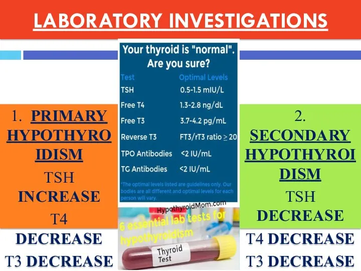 LABORATORY INVESTIGATIONS 1. PRIMARY HYPOTHYROIDISM TSH INCREASE T4 DECREASE T3 DECREASE 2. SECONDARY