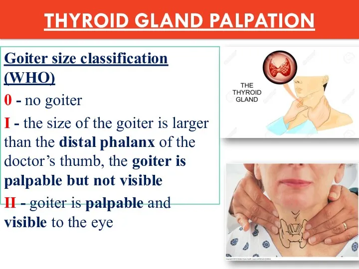 THYROID GLAND PALPATION Goiter size classification (WHO) 0 - no