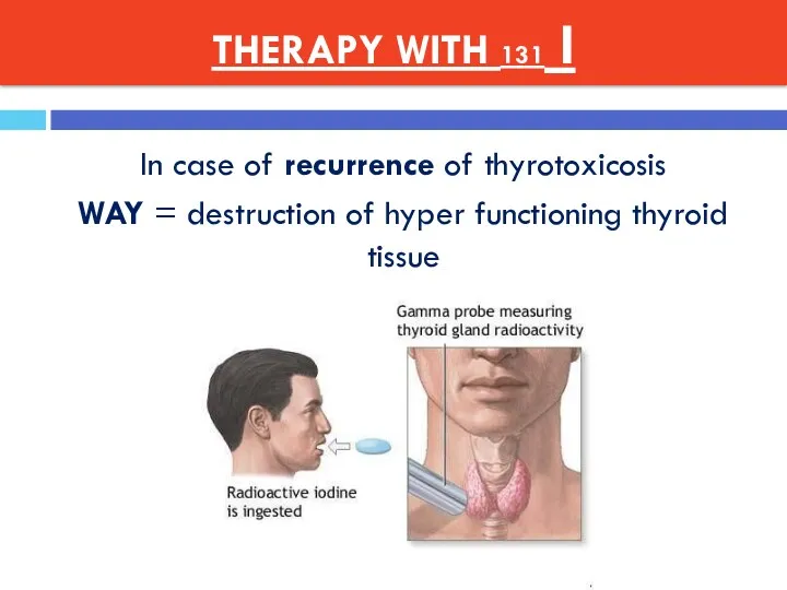 THERAPY WITH 131 I In case of recurrence of thyrotoxicosis WAY = destruction