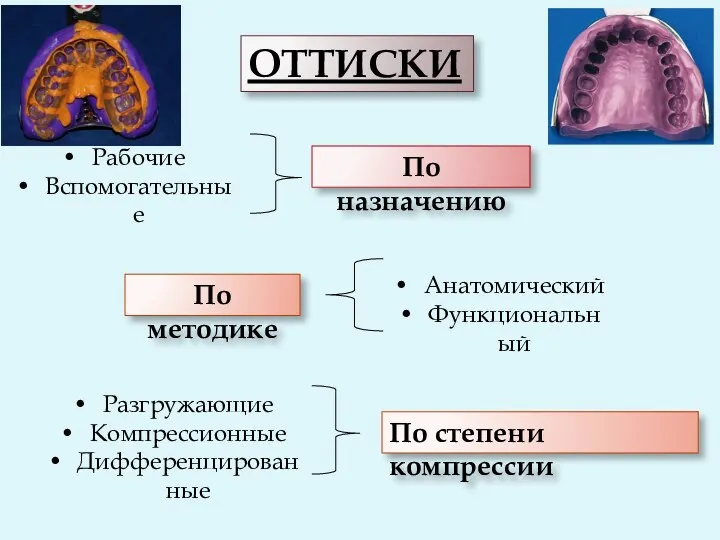 ОТТИСКИ По назначению Рабочие Вспомогательные По методике Анатомический Функциональный По степени компрессии Разгружающие Компрессионные Дифференцированные