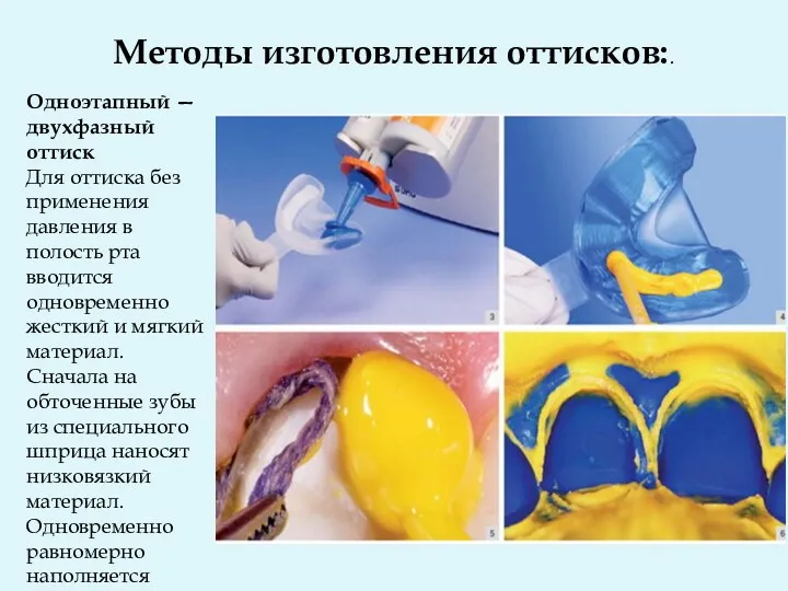 Методы изготовления оттисков:. Одноэтапный — двухфазный оттиск Для оттиска без