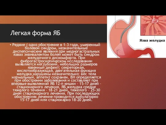 Легкая форма ЯБ Редкие ( одно обострение в 1-3 года, умеренный болевой синдром,