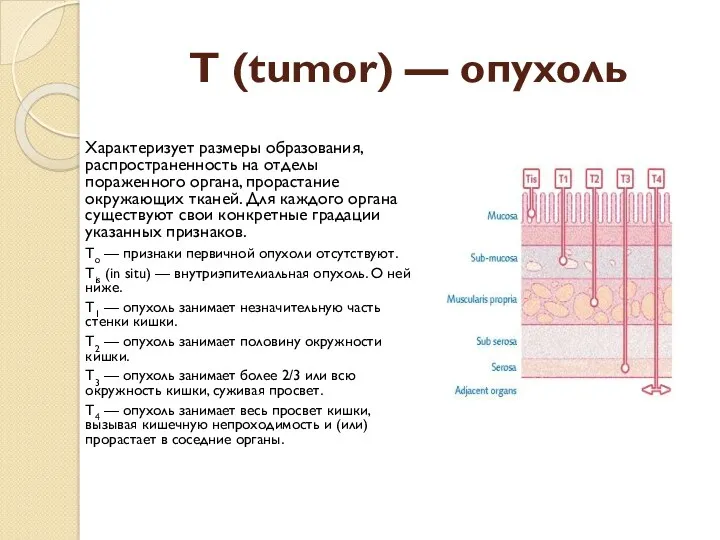 T (tumor) — опухоль Характеризует размеры образования, распространенность на отделы пораженного органа, прорастание