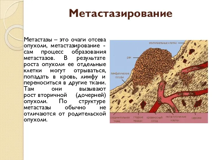 Метастазирование Метастазы – это очаги отсева опухоли, метастазирование - сам процесс образования метастазов.