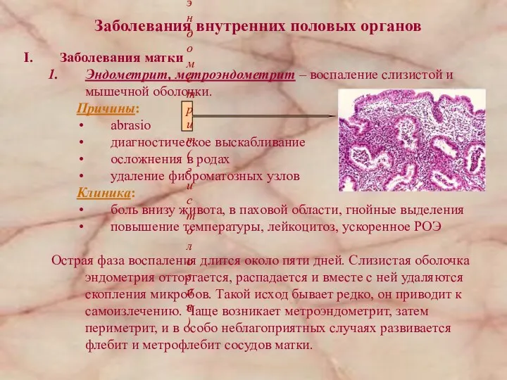 Заболевания внутренних половых органов Заболевания матки Эндометрит, метроэндометрит – воспаление слизистой и мышечной