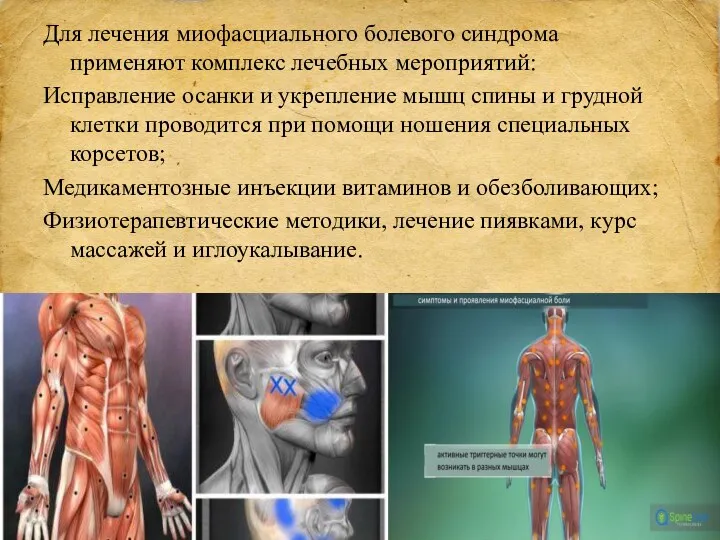 Для лечения миофасциального болевого синдрома применяют комплекс лечебных мероприятий: Исправление