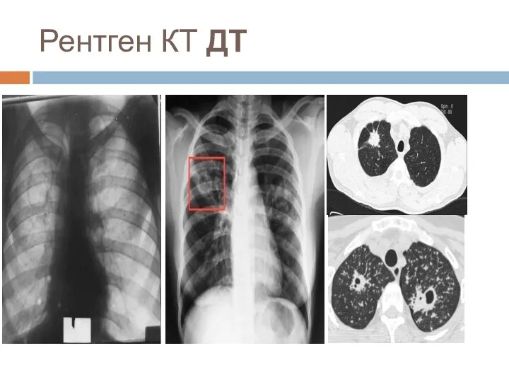 Рентген КТ ДТ