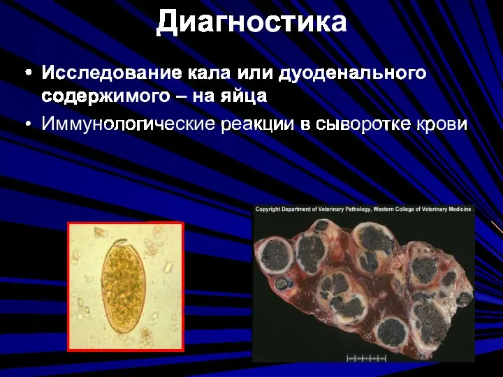 Диагностика Исследование кала или дуоденального содержимого – на яйца Иммунологические реакции в сыворотке крови