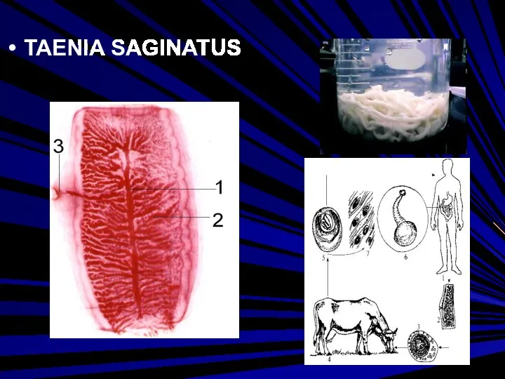 TAENIA SAGINATUS