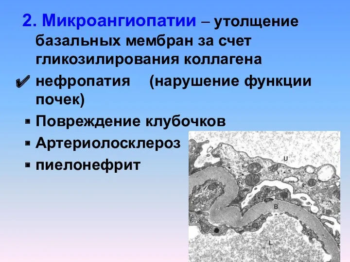 2. Микроангиопатии – утолщение базальных мембран за счет гликозилирования коллагена