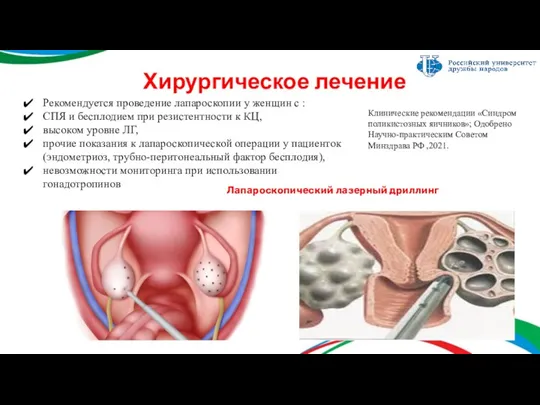 Хирургическое лечение Рекомендуется проведение лапароскопии у женщин с : СПЯ