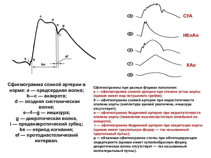 Сфигмограмма сонной артерии в норме: а — предсердная волна; b—с