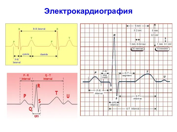 Электрокардиография