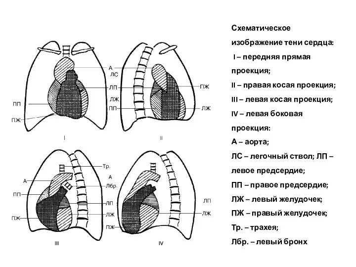 Схематическое изображение тени сердца: I – передняя прямая проекция; II