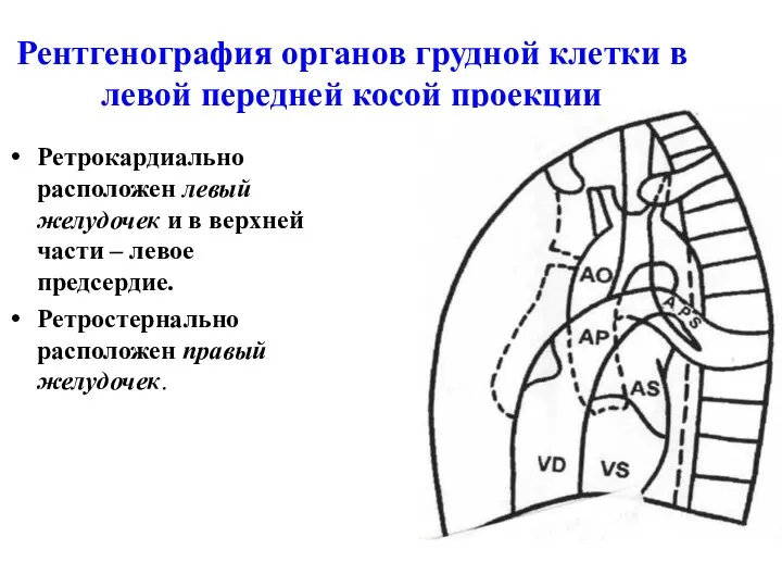 Рентгенография органов грудной клетки в левой передней косой проекции Ретрокардиально