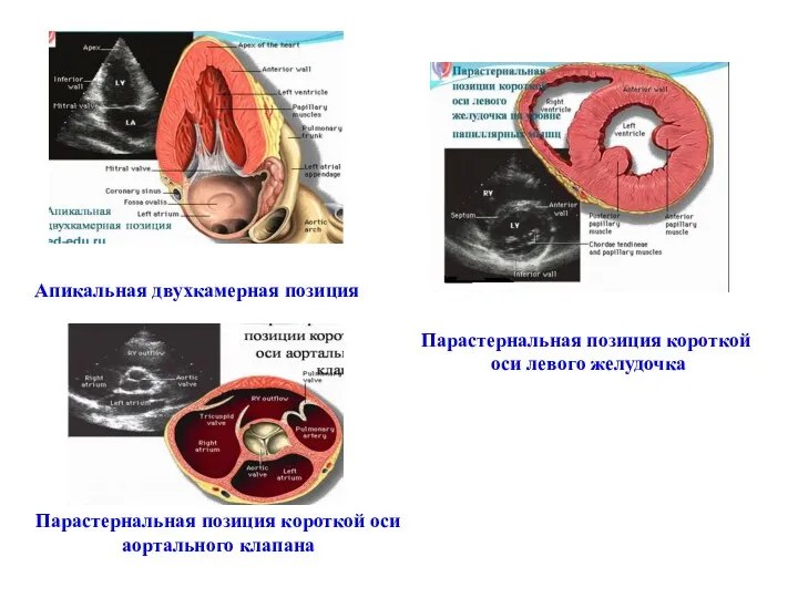 Апикальная двухкамерная позиция Парастернальная позиция короткой оси левого желудочка Парастернальная позиция короткой оси аортального клапана