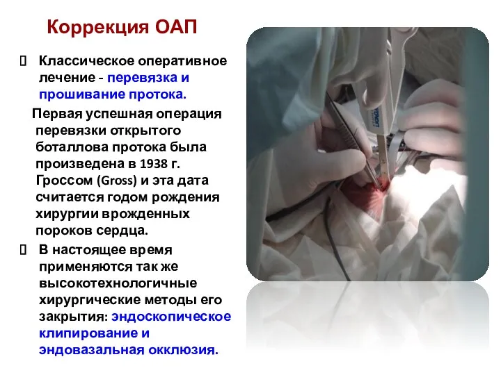 Классическое оперативное лечение - перевязка и прошивание протока. Первая успешная