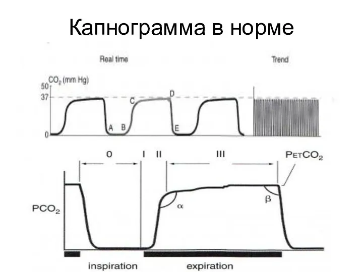 Капнограмма в норме