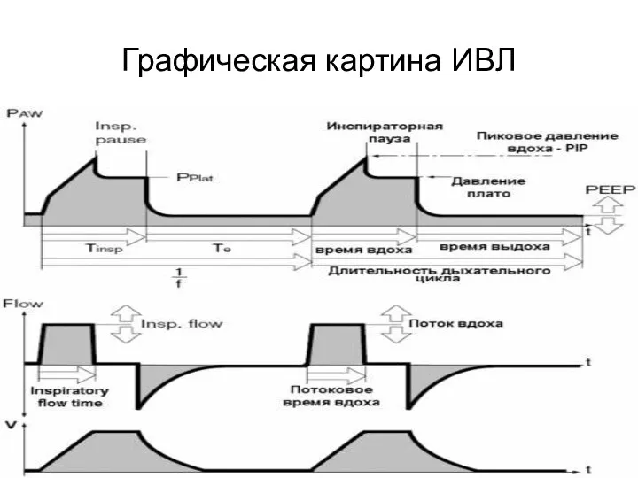 Графическая картина ИВЛ