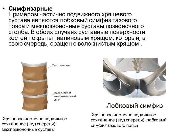 Симфизарные Примером частично подвижного хрящевого сустава являются лобковый симфиз тазового пояса и межпозвоночные