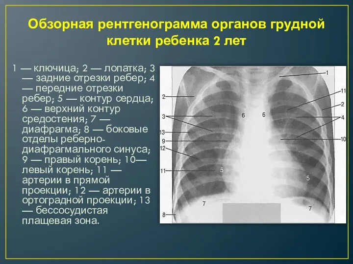 Обзорная рентгенограмма органов грудной клетки ребенка 2 лет 1 —