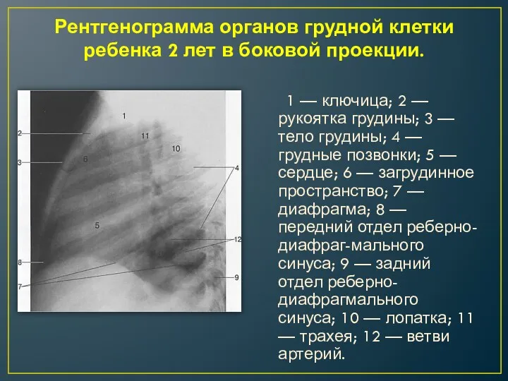 Рентгенограмма органов грудной клетки ребенка 2 лет в боковой проекции.