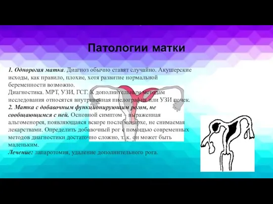 Патологии матки 1. Однорогая матка. Диагноз обычно ставят случайно. Акушерские