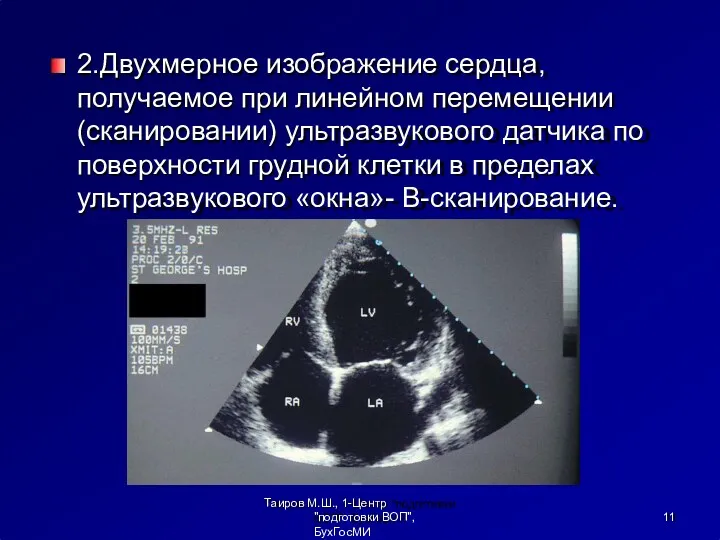 2.Двухмерное изображение сердца, получаемое при линейном перемещении (сканировании) ультразвукового датчика