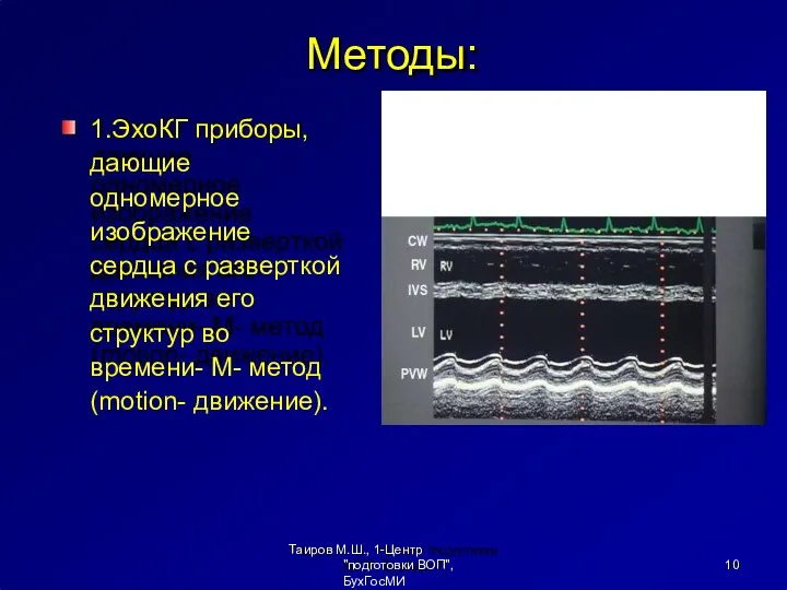 Методы: 1.ЭхоКГ приборы, дающие одномерное изображение сердца с разверткой движения