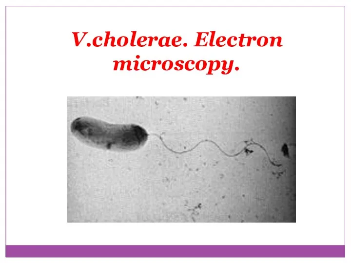 V.cholerae. Electron microscopy.