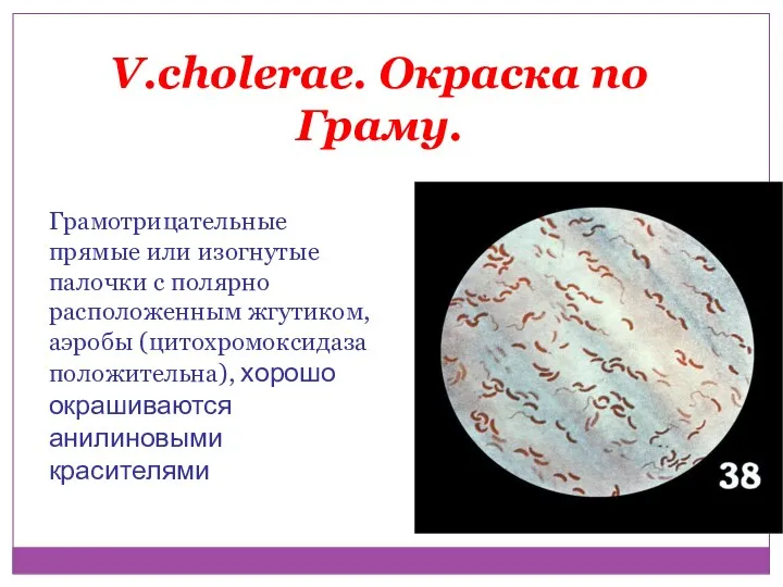 V.cholerae. Окраска по Граму. Грамотрицательные прямые или изогнутые палочки с