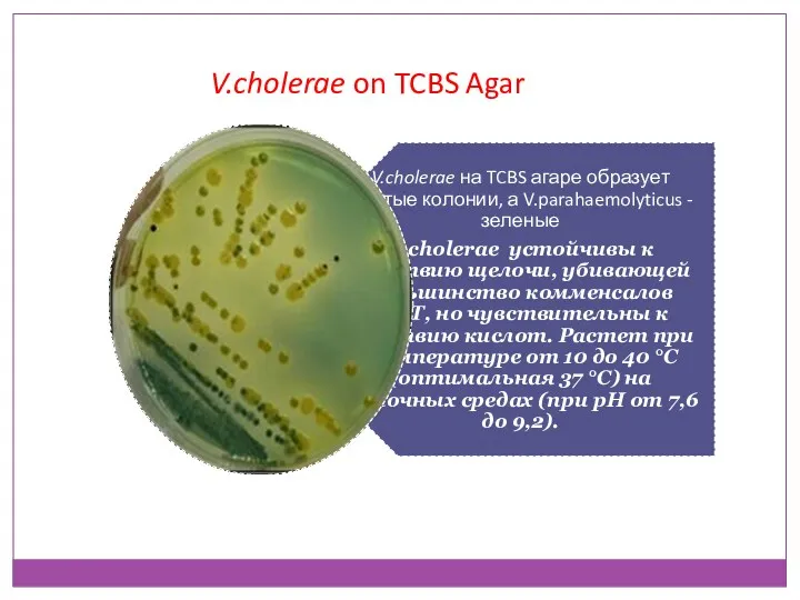 V.cholerae on TCBS Agar