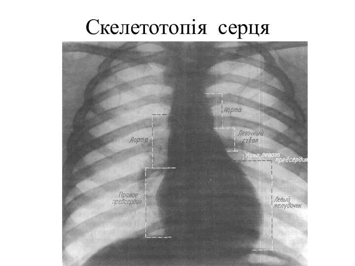 Скелетотопія серця