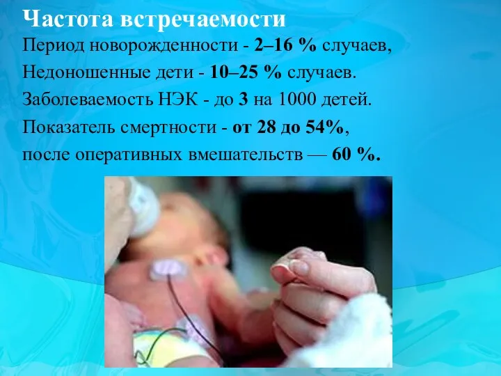 Период новорожденности - 2–16 % случаев, Недоношенные дети - 10–25