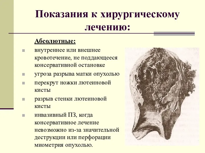 Показания к хирургическому лечению: Абсолютные: внутреннее или внешнее кровотечение, не