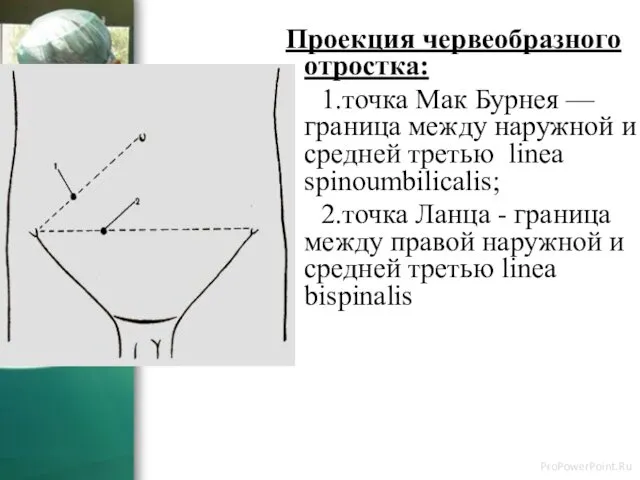 Проекция червеобразного отростка: 1.точка Мак Бурнея — граница между наружной