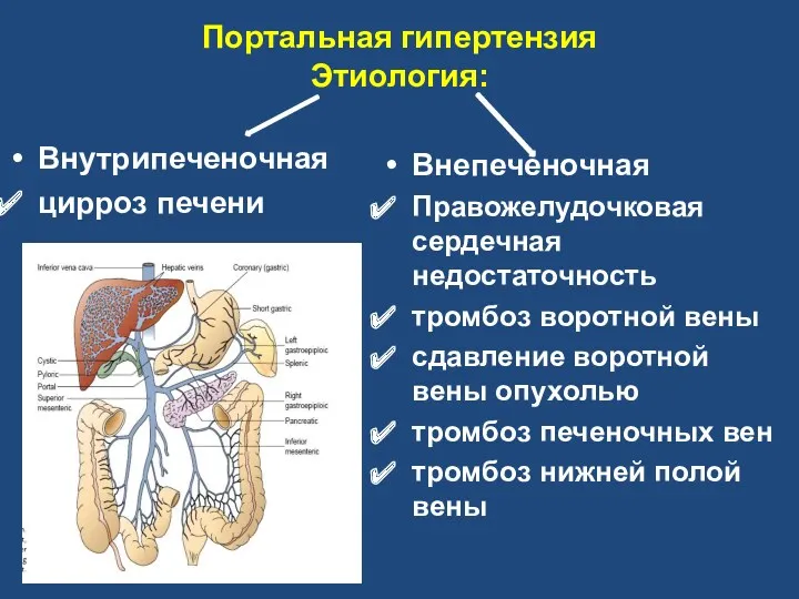 Портальная гипертензия Этиология: Внутрипеченочная цирроз печени Внепеченочная Правожелудочковая сердечная недостаточность