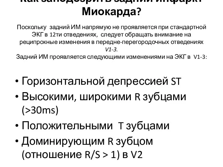 Как заподозрить задний инфаркт Миокарда? Поскольку задний ИМ напрямую не