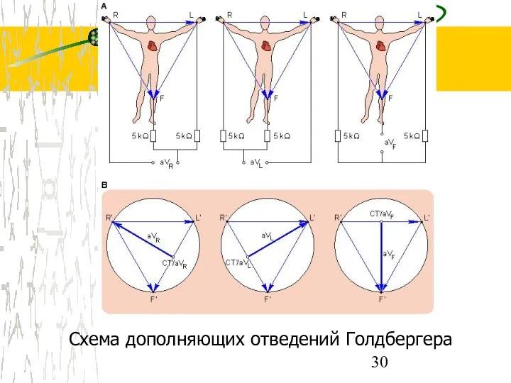 Схема дополняющих отведений Голдбергера