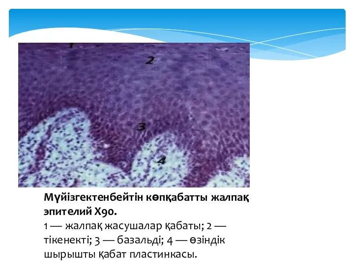 Мүйізгектенбейтін көпқабатты жалпақ эпителий Х90. 1 — жалпақ жасушалар қабаты; 2 — тікенекті;