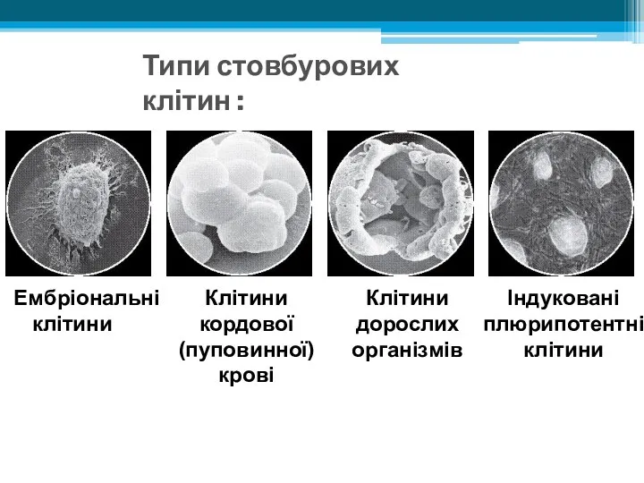 Ембріональні клітини Типи стовбурових клітин : Клітини кордової (пуповинної) крові Клітини дорослих організмів Індуковані плюрипотентні клітини