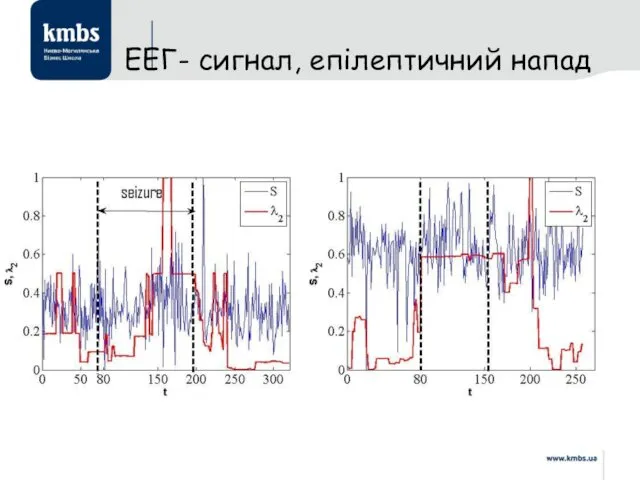 ЕЕГ- сигнал, епілептичний напад