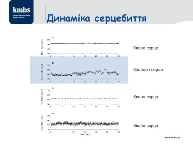 Динаміка серцебиття Динаміка серцебиття Здорове серце Хворе серце Хворе серце Хворе серце