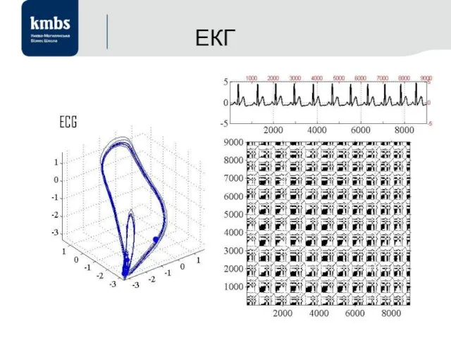 ЕКГ