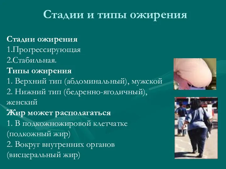 Стадии и типы ожирения Стадии ожирения 1.Прогрессирующая 2.Стабильная. Типы ожирения