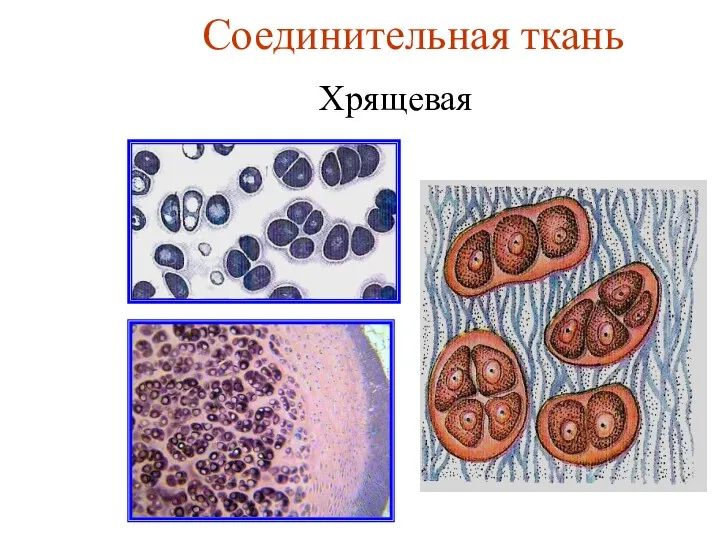 Соединительная ткань Хрящевая