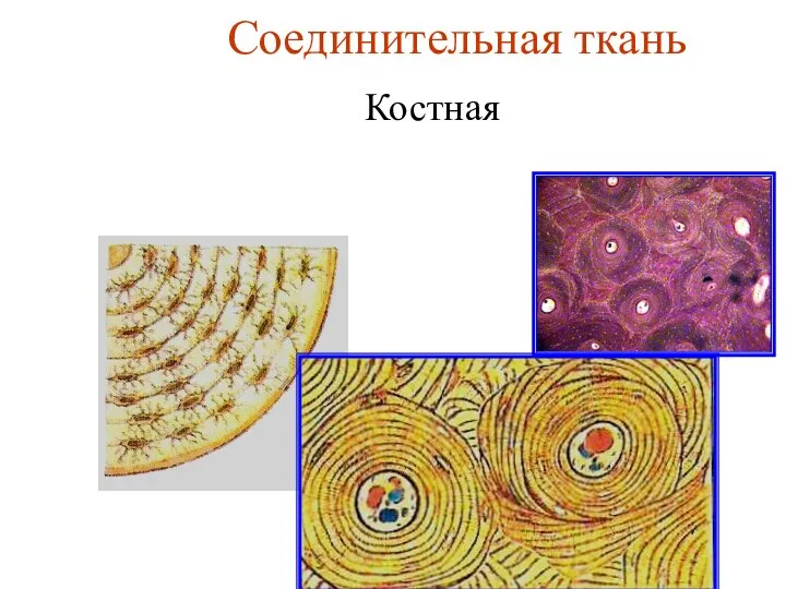 Соединительная ткань Костная