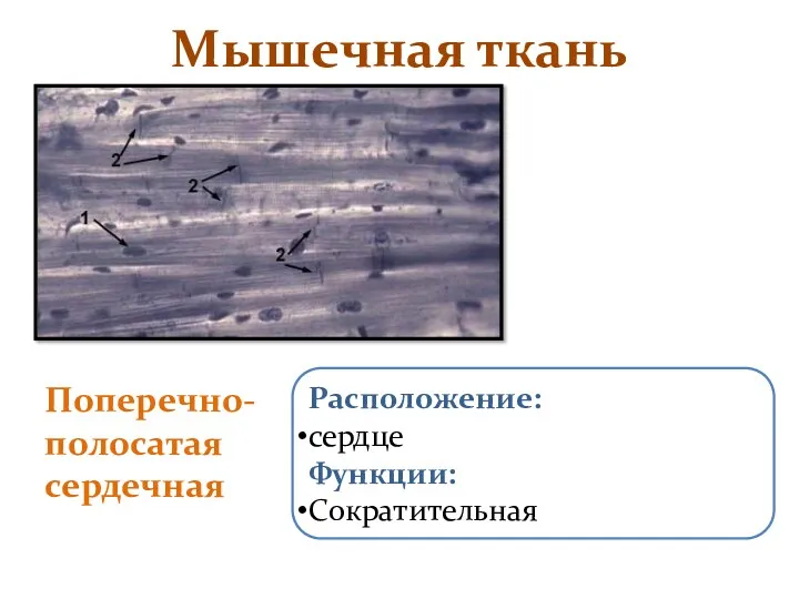 Мышечная ткань Поперечно-полосатая сердечная Расположение: сердце Функции: Сократительная